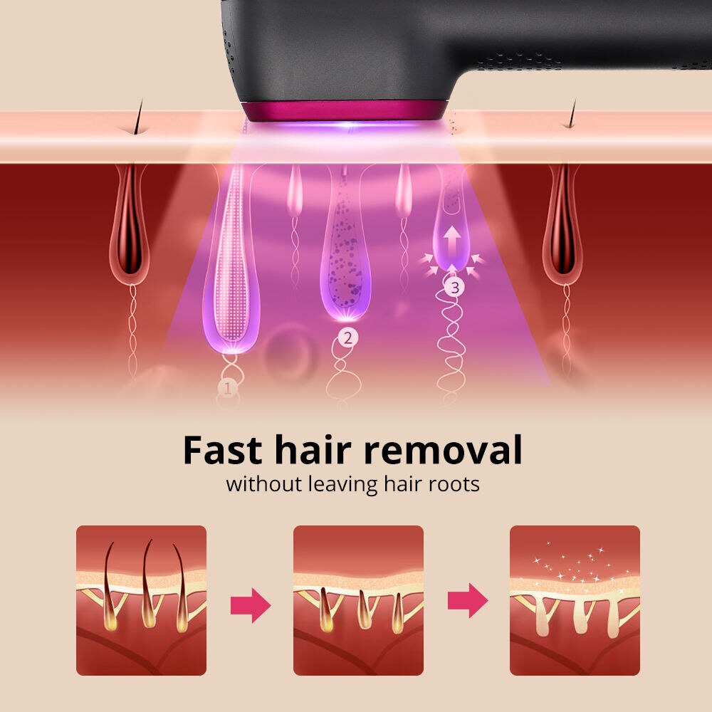 Sweet™ FlashPro IPL Hair Removal